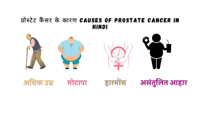 Prostate Cancer Symptoms in Hindi: प्रोस्टेट कैंसर के लक्षण एवं कारण हिंदी में| Prostate Cancer Causes and 5 Symptoms in Hindi