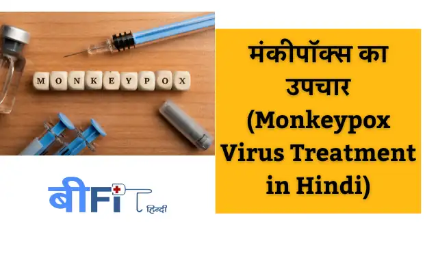 मंकीपॉक्स वायरस से कैसे बचा जाये  (Monkeypox virus Prevention in Hindi)