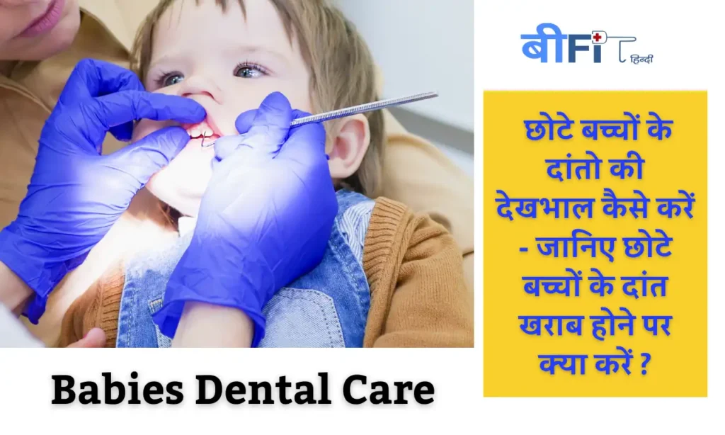 Babies Dental Care: छोटे बच्चों के दांतो की देखभाल कैसे करें – जानिए छोटे बच्चों के दांत खराब होने पर क्या करें ?