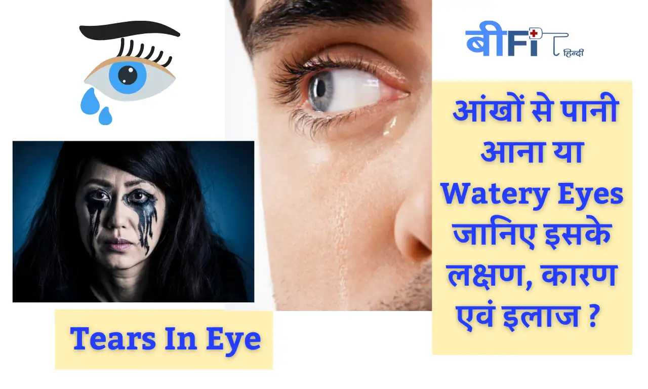 Tears In Eye: आंखों से पानी आना या Watery Eyes जानिए इसके लक्षण, कारण एवं इलाज ? |Tears In Eye Know About Its Symptoms Causes and Best Treatments in Hindi