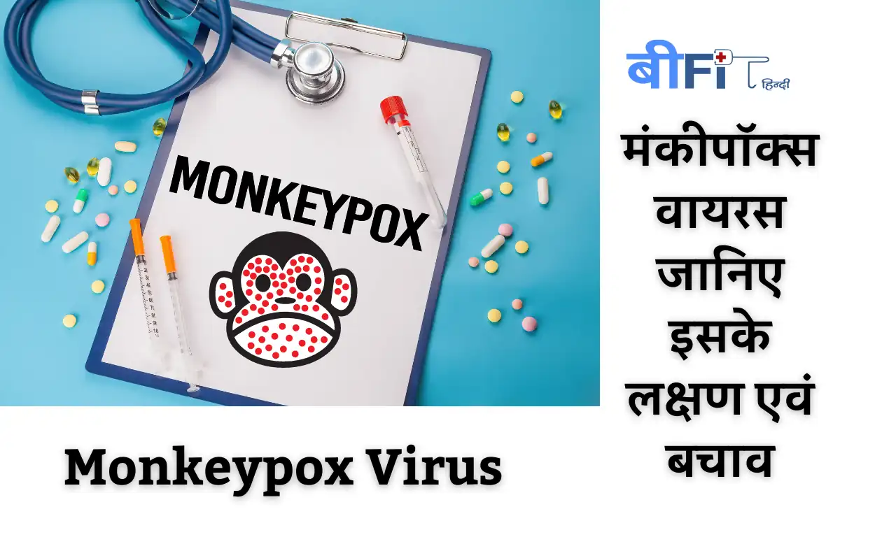 Monkeypox Virus : मंकीपॉक्स वायरस जानिए इसके लक्षण एवं बचाव | 11 Symptoms of Monkeypox Virus , Causes and Treatment in Hindi