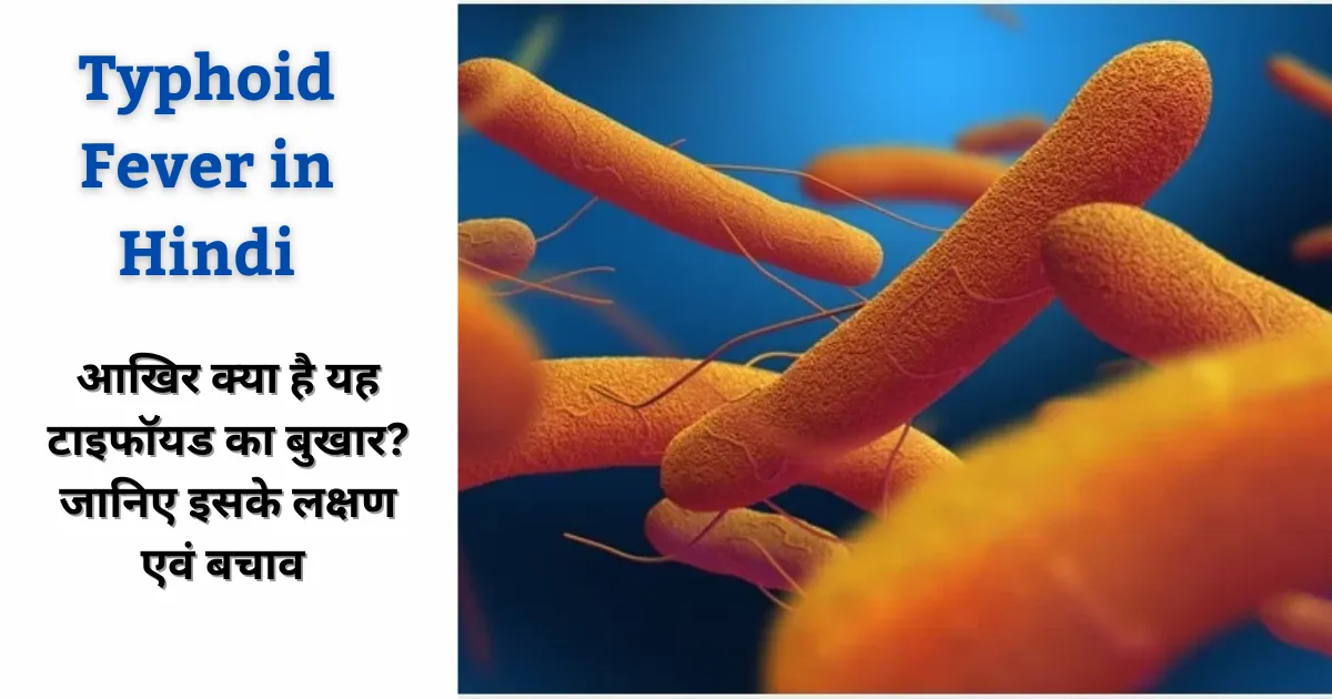 Home 1 Typhoid Fever in Hindi